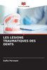 Les Lésions Traumatiques Des Dents
