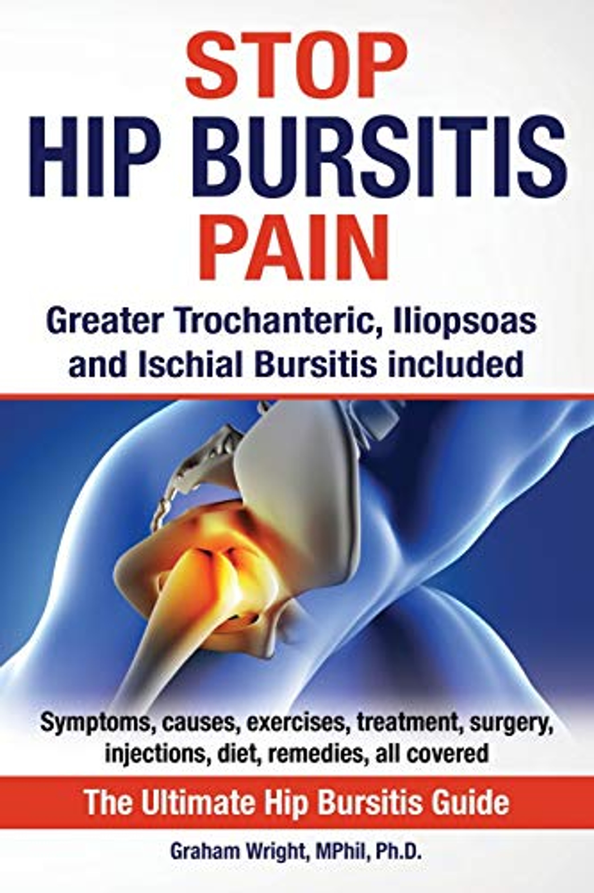 Stop Hip Bursitis Pain Greater Trochanteric Iliopsoas And Ischial