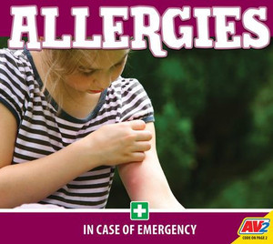 Allergies
