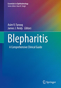 Blepharitis: A Comprehensive Clinical Guide (Essentials in Ophthalmology)
