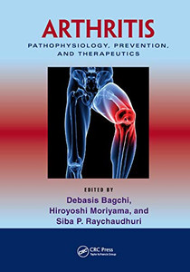 Arthritis: Pathophysiology, Prevention, and Therapeutics Arthritis: Pathophysiology, Prevention, and Therapeutics