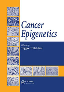 Cancer Epigenetics Cancer Epigenetics