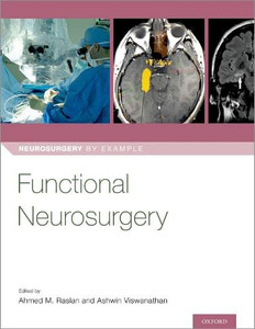 Functional Neurosurgery (Neurosurgery by Example) Functional Neurosurgery (Neurosurgery by Example)