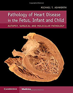 Pathology Of Heart Disease In The Fetus, Infant And Child: Autopsy, Surgical And Molecular Pathology Pathology Of Heart Disease In The Fetus, Infant And Child: Autopsy, Surgical And Molecular Pathology