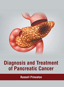 Diagnosis And Treatment Of Pancreatic Cancer
