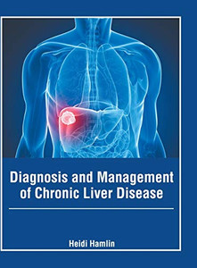 Diagnosis And Management Of Chronic Liver Disease