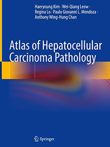 Atlas Of Hepatocellular Carcinoma Pathology
