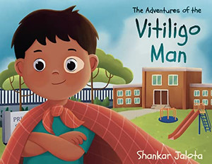 The Adventures Of The Vitiligo Man The Adventures Of The Vitiligo Man