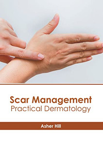 Scar Management: Practical Dermatology Scar Management: Practical Dermatology