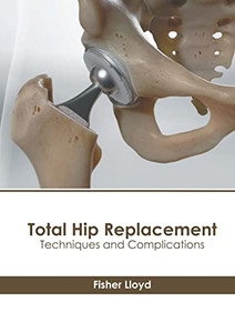 Total Hip Replacement: Techniques and Complications Total Hip Replacement: Techniques and Complications