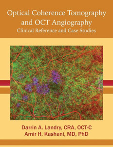 Optical Coherence Tomography And Oct Angiography: Clinical Reference And Case Studies