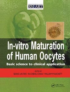 In Vitro Maturation of Human Oocytes In Vitro Maturation of Human Oocytes