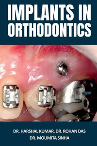 Implants In Orthodontics Implants In Orthodontics