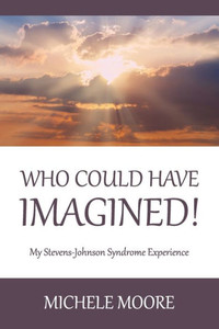 Who Could Have Imagined!: My Stevens-Johnson Syndrome Experience Who Could Have Imagined!: My Stevens-Johnson Syndrome Experience