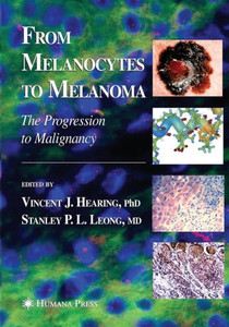 From Melanocytes To Melanoma: The Progression To Malignancy From Melanocytes To Melanoma: The Progression To Malignancy