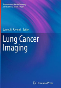 Lung Cancer Imaging (Contemporary Medical Imaging)