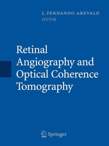 Retinal Angiography And Optical Coherence Tomography