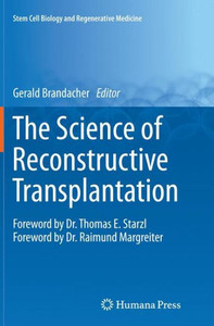The Science Of Reconstructive Transplantation (Stem Cell Biology And Regenerative Medicine) The Science Of Reconstructive Transplantation (Stem Cell Biology And Regenerative Medicine)