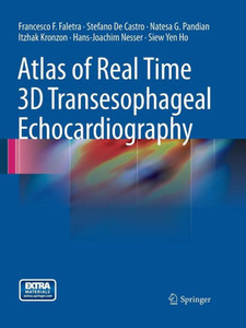 Atlas Of Real Time 3D Transesophageal Echocardiography Atlas Of Real Time 3D Transesophageal Echocardiography