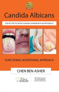 Candida Albicans: Step by Step to Defeat Candida Overgrowth Nutritionally