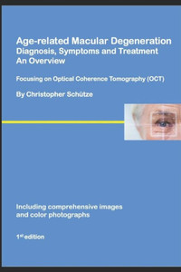 Age-related Macular Degeneration, Diagnosis, Symptoms and Treatment, An Overview: Focusing on Optical Coherence Tomography (Ophthalmology series No. 1)