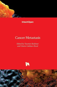 Cancer Metastasis Cancer Metastasis