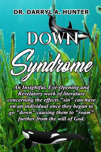 Down Syndrome Down Syndrome