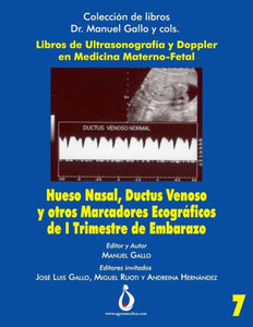 Hueso Nasal, Ductus Venoso y otros marcadores ecográficos de I trimestre de Embarazo (Coleccion de libros Dr. Manuel Gallo y cols) (Spanish Edition)