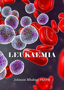 Leukaemia Leukaemia
