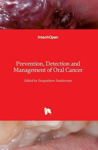 Prevention, Detection And Management Of Oral Cancer