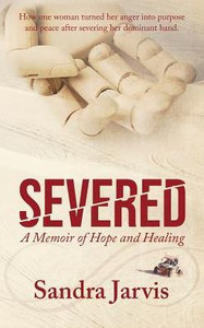 Severed : A Memoir Of Hope And Healing Severed : A Memoir Of Hope And Healing