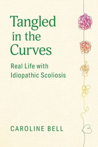 Tangled In The Curves: Real Life With Idiopathic Scoliosis