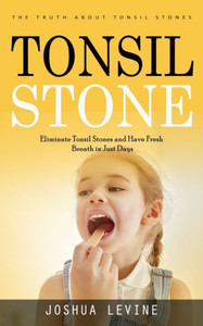 Tonsil Stones: The Truth About Tonsil Stones (Eliminate Tonsil Stones And Have Fresh Breath In Just Days!)
