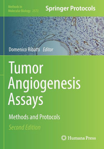 Tumor Angiogenesis Assays: Methods and Protocols (Methods in Molecular Biology, 2572) Tumor Angiogenesis Assays: Methods and Protocols (Methods in Molecular Biology, 2572)