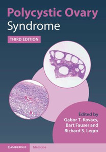 Polycystic Ovary Syndrome Polycystic Ovary Syndrome