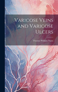Varicose Veins And Varicose Ulcers Varicose Veins And Varicose Ulcers