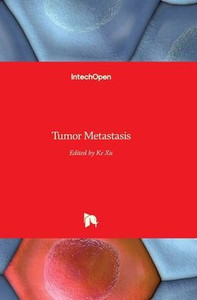 Tumor Metastasis Tumor Metastasis