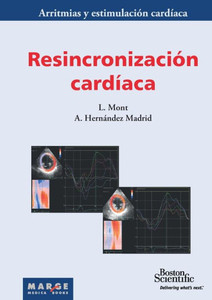 Resincronización cardíaca
