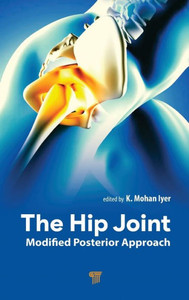The Hip Joint : Modified Posterior Approach The Hip Joint : Modified Posterior Approach