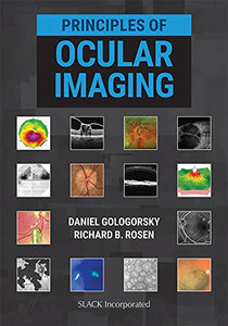 Principles Of Ocular Imaging