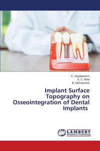 Implant Surface Topography on Osseointegration of Dental Implants Implant Surface Topography on Osseointegration of Dental Implants