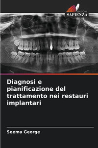 Diagnosi e pianificazione del trattamento nei restauri implantari