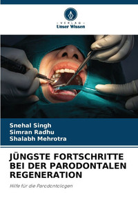 Jüngste Fortschritte Bei Der Parodontalen Regeneration Jüngste Fortschritte Bei Der Parodontalen Regeneration