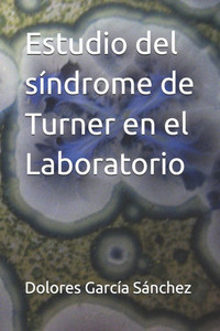 Estudio del síndrome de Turner en el Laboratorio