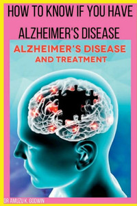 How to know if you have Alzheimers disease: Sign And Symptoms for Alzheimer's disease