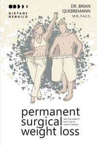 Permanent Surgical Weight Loss: Why You Want It, Why I Do It, How It Works