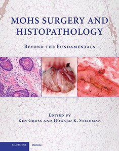 Mohs Surgery And Histopathology: Beyond The Fundamentals