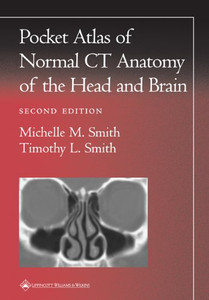 Pocket Atlas Of Normal Ct Anatomy Of The Head And Brain (Radiology Pocket Atlas Series)