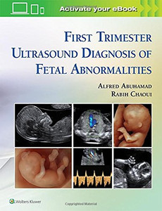 First Trimester Ultrasound Diagnosis Of Fetal Abnormalities First Trimester Ultrasound Diagnosis Of Fetal Abnormalities