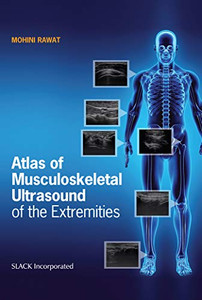 Atlas of Musculoskeletal Ultrasound of the Extremities Atlas of Musculoskeletal Ultrasound of the Extremities